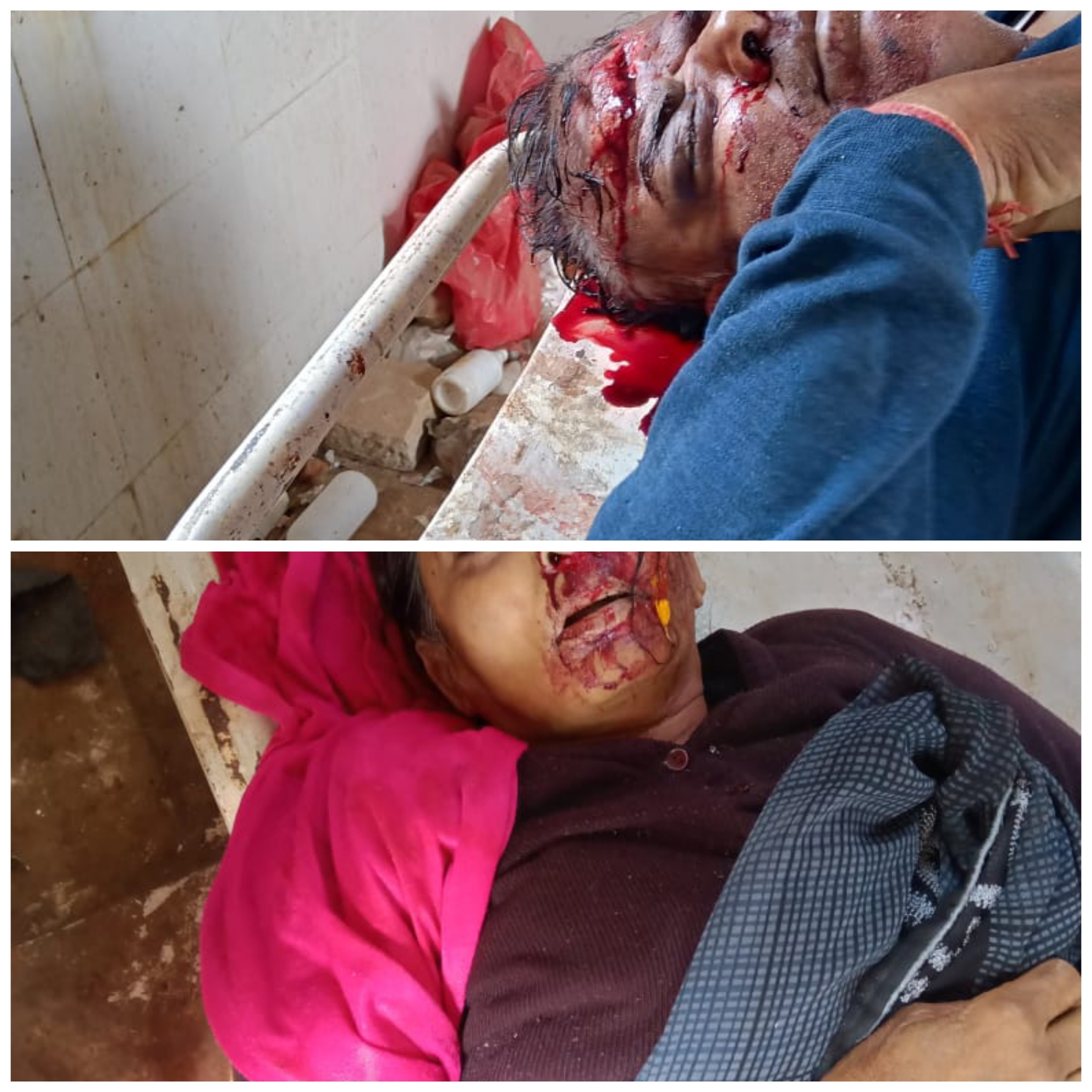  हृदय विदारक भीषड़ सड़क हादसे में दो की मौत व दो की हालत गम्भीर मऊगंज ओवरब्रिज के पास ऑल्टो कार को हाइवा ने मारी जोरदार ठोकर